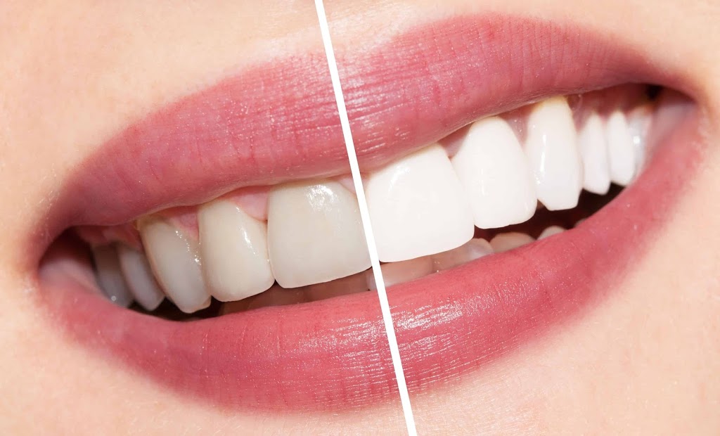 Arborg Family Dental | 145 Sunset Blvd, Arborg, MB R0C 0A0, Canada | Phone: (204) 376-2624