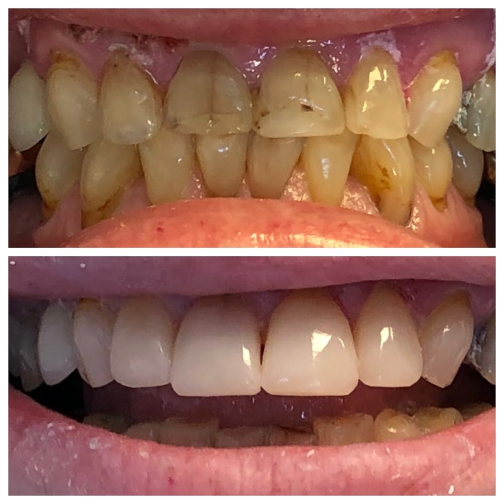 Dental Team on 118 | Main Floor, 4408 118 Ave NW, Edmonton, AB T5W 1A7, Canada | Phone: (780) 471-4801