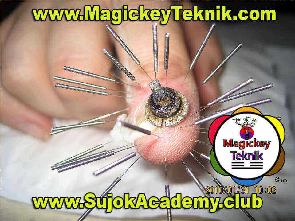 SU JOK Academy of Canada / Académie de SU JOK du Canada | 5919 84 Ave SE, Calgary, AB T2C 4S1, Canada | Phone: (514) 800-8693