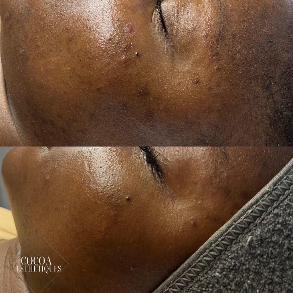 Cocoa Esthetiques | 350 (3rd Floor, 2414 16 Ave NW Suite 24, Calgary, AB T2M 0M5, Canada | Phone: (587) 883-9943