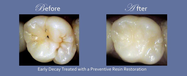 Westmount Dental | 8010 Bathurst St c4, Thornhill, ON L4J 0B8, Canada | Phone: (905) 881-8284
