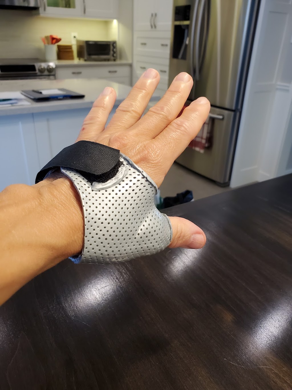 Joanne Smith Hand Therapist | 5691 Highfield Dr, Burnaby, BC V5B 1E4, Canada | Phone: (604) 299-7557