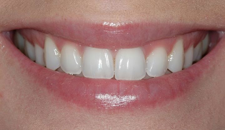 Dr Marie-Lou Landry | 1145 Boulevard Lebourgneuf, Québec, QC G2K 2K8, Canada | Phone: (418) 624-7333
