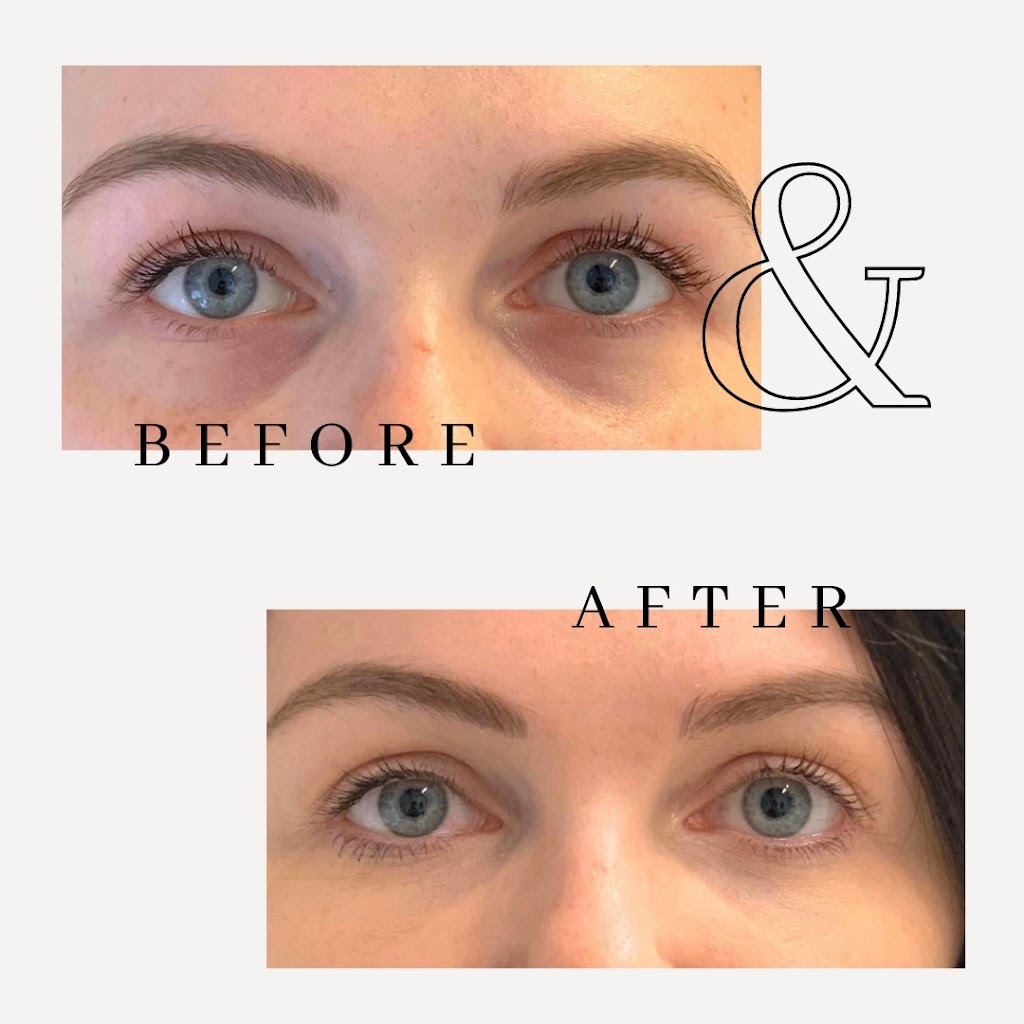 Calgary Facial Rejuventation | 1632 14 Ave NW Suite 211, Calgary, AB T2N 1M6, Canada | Phone: (403) 289-7370