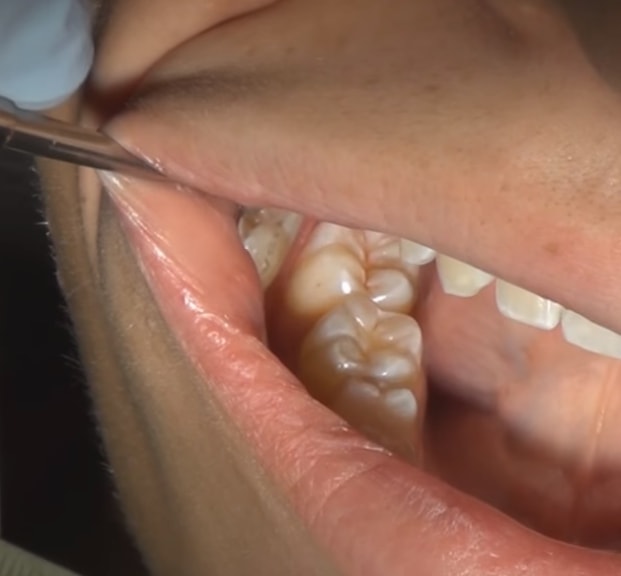 Maple Ridge Dentist - Cedar Ridge Dental | 22195 Dewdney Trunk Rd, Maple Ridge, BC V2X 3H7, Canada | Phone: (604) 463-3931