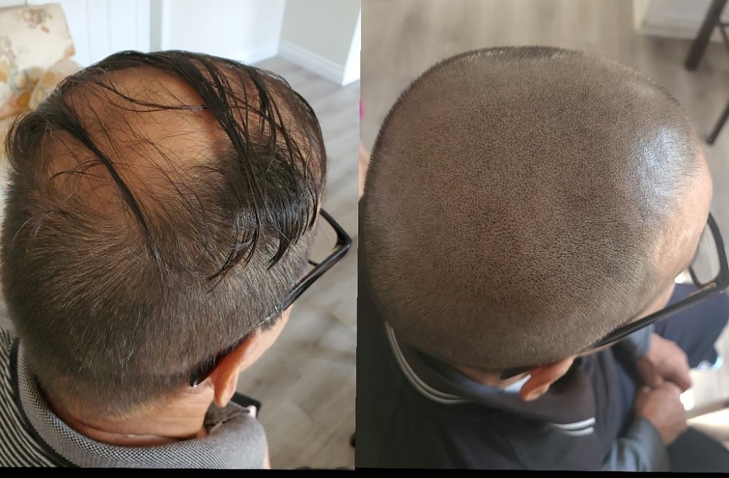 Nick Micropigmentation | 6150 Valley Way Unit A118, Niagara Falls, ON L2E 1X9, Canada | Phone: (289) 321-2183