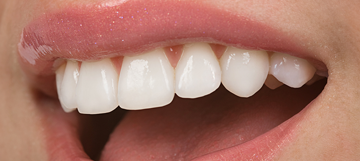 LYNDEN PARK DENTAL | Dr. Shawn Monga | 84 Lynden Rd, Brantford, ON N3R 6B8, Canada | Phone: (519) 751-0888