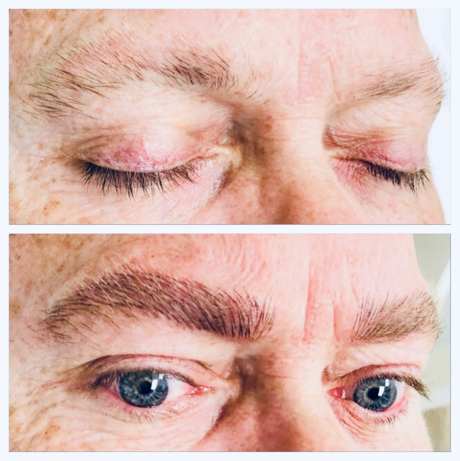 iBrow & Laser Clinic | 1595 Bedford Highway Suite 228, Sunnyside Mall, Bedford, NS B4A 3Y4, Canada | Phone: (902) 406-9526