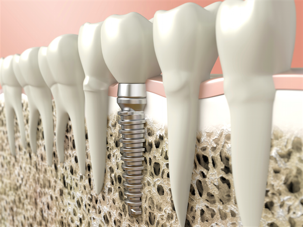 White Cedar Dental Care | 610 Huronia Rd #7, Barrie, ON L4N 0W5, Canada | Phone: (705) 737-1151