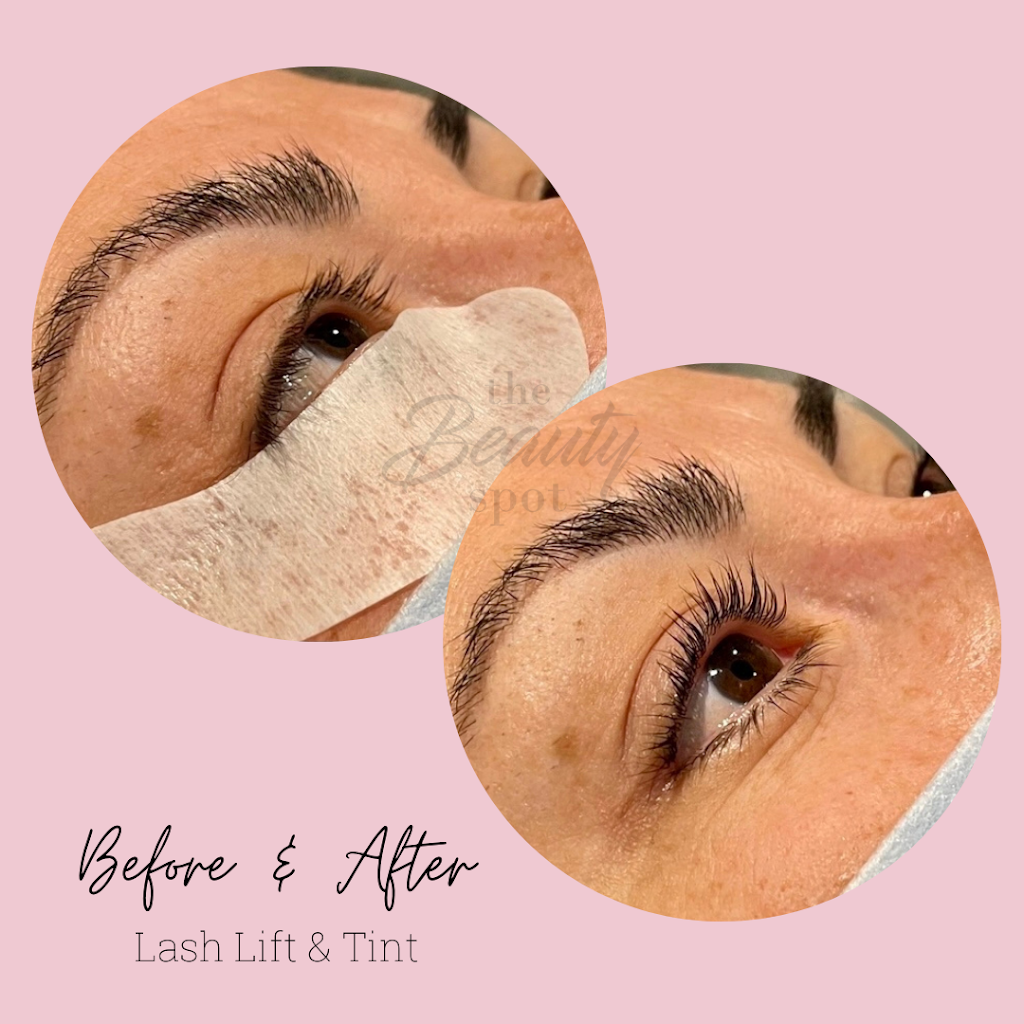 The Beauty Spot Corp. | 397 Kleinburg Smt Wy #1, Kleinburg, ON L4H 4T1, Canada | Phone: (647) 778-7356