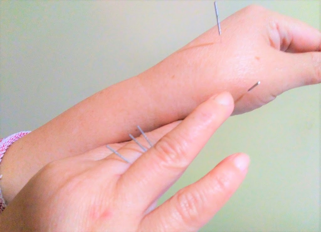 green nature acupuncture | 15159 81 Ave, Surrey, BC V3S 7B9, Canada | Phone: (778) 317-2366