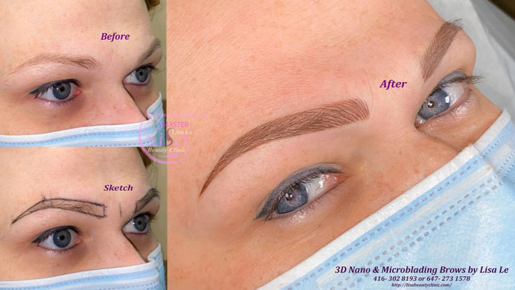Lisa Beauty Clinic | 3220 Weston Rd, North York, ON M9M 2T7, Canada | Phone: (647) 273-1578