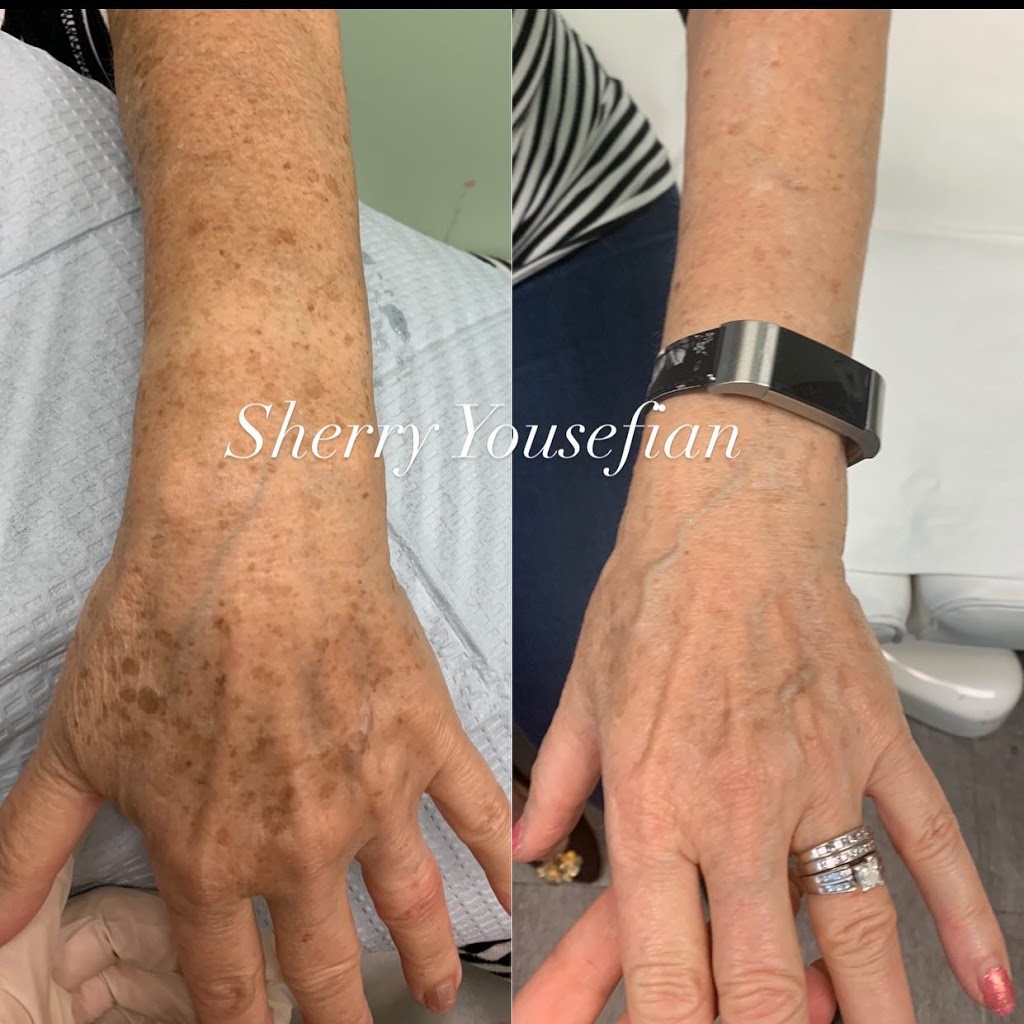 Medic laser and Skin care | 1296 Pacific Blvd, Vancouver, BC V6Z 2V1, Canada | Phone: (604) 633-2474