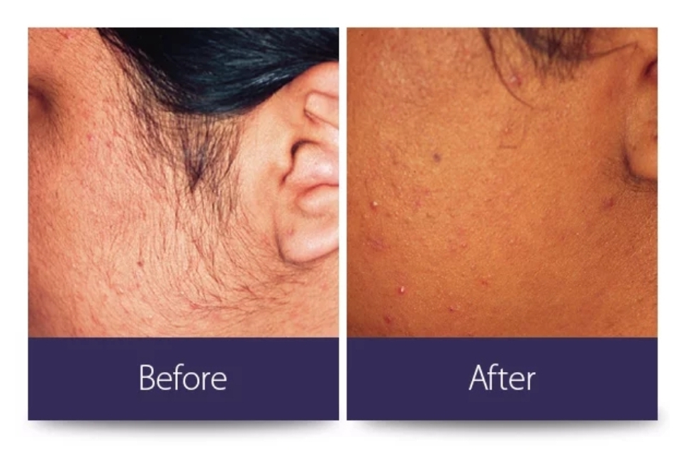 Ora Beauty | 10211 Keele St unit 16, Maple, ON L6A 4R7, Canada | Phone: (647) 746-3366