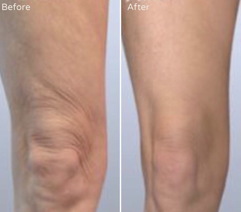 Flawless Beauty & Health Spa | 161 Colborne St W, Brantford, ON N3T 1L3, Canada | Phone: (226) 920-8244