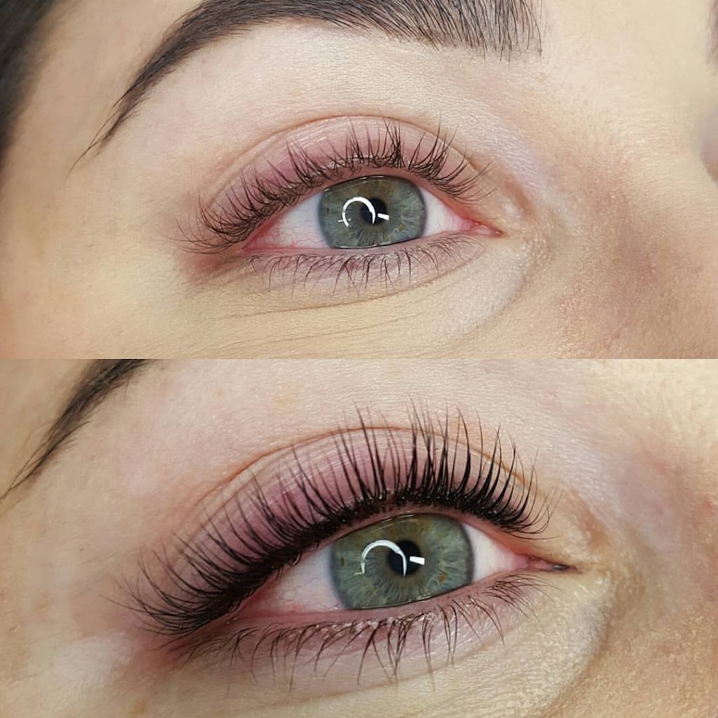 Laser Médic Spa | 95 Bd de Gaulle, Lorraine, QC J6Z 3R8, Canada | Phone: (450) 987-2802