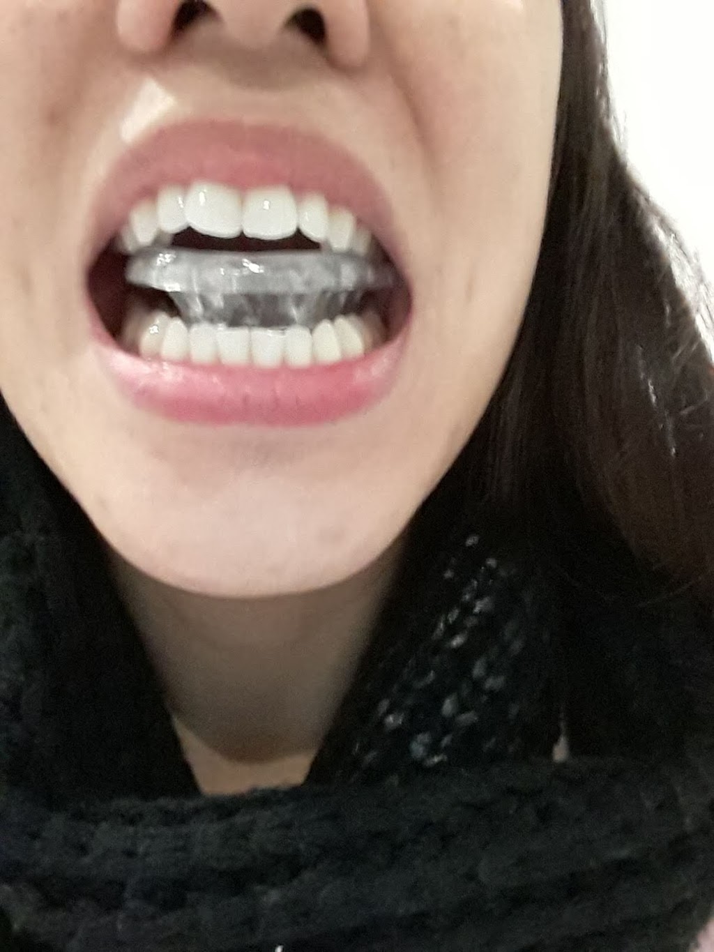 Belmont Dental Care | 564 Belmont Ave W Unit 108B, Kitchener, ON N2M 5N6, Canada | Phone: (226) 647-9222