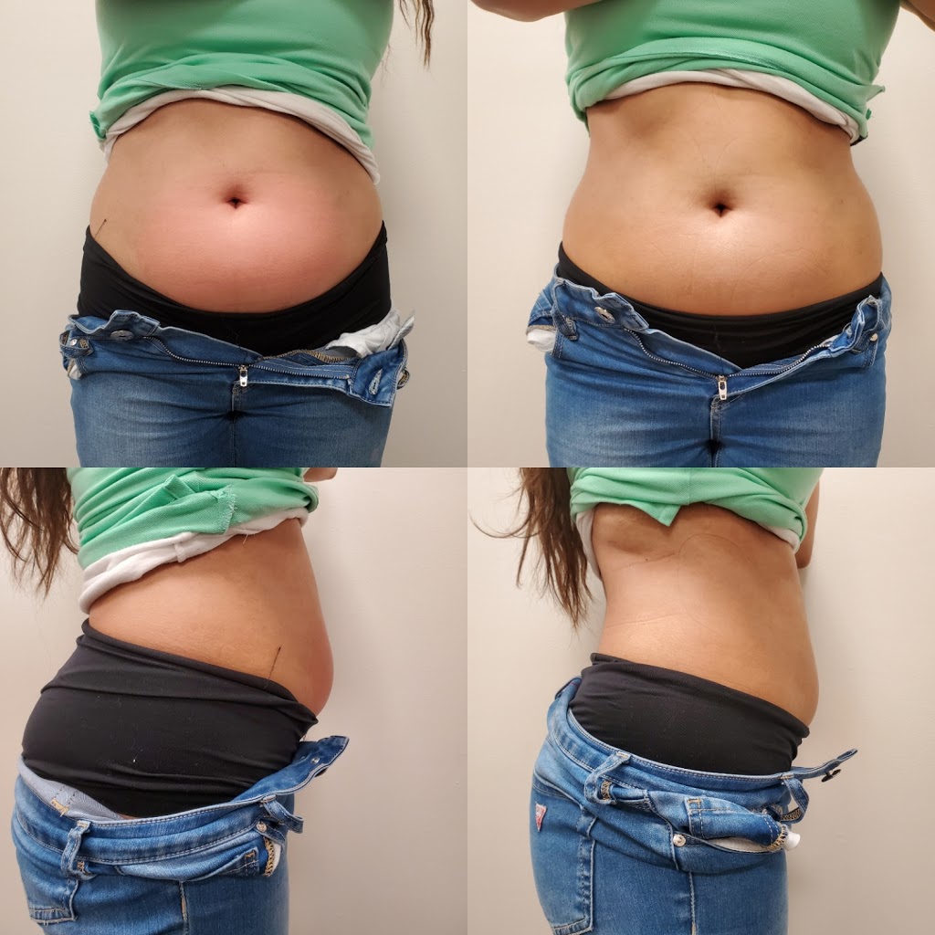 SculptedYou | 4050 Walker Rd # 207, Windsor, ON N8W 3T5, Canada | Phone: (519) 551-6090