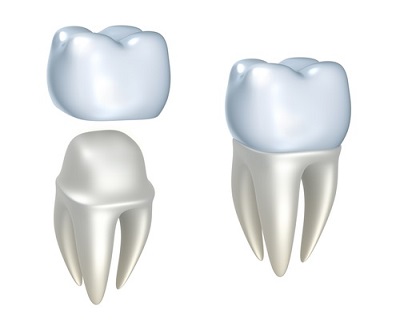 Oshawa Dentists | 53 Conlin Rd E, Oshawa, ON L1H 7K4, Canada | Phone: (905) 925-5194