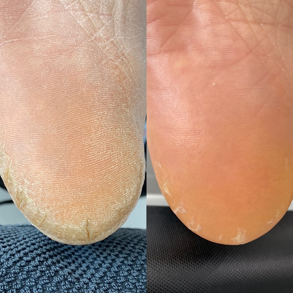 White Lotus Nails | 15345 BC-10, Surrey, BC V3S 0X9, Canada | Phone: (604) 574-5020