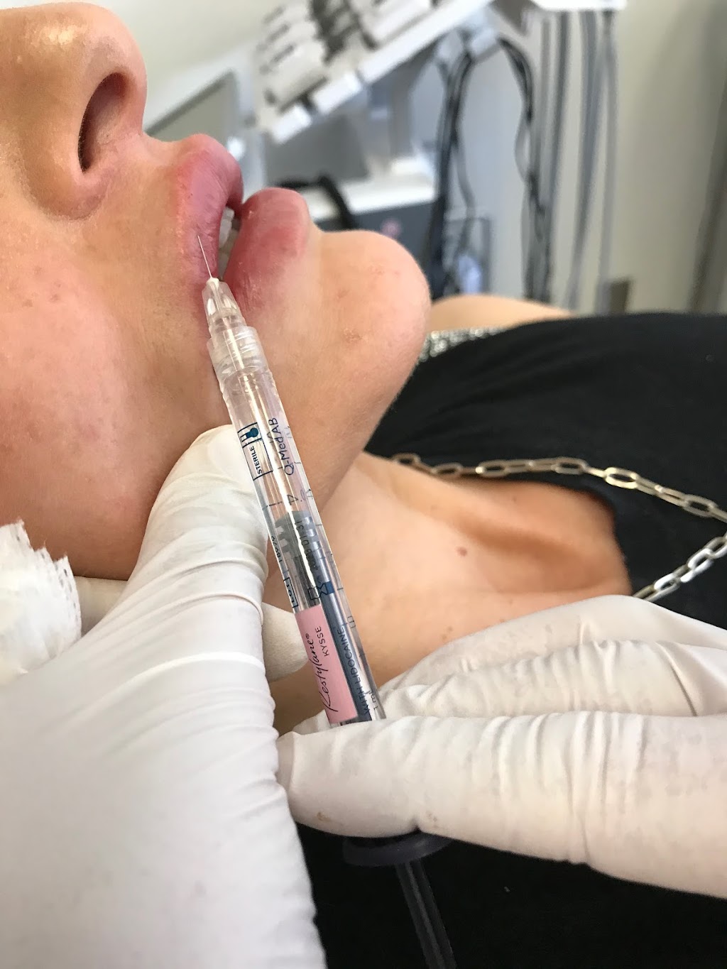 Luminesse Laser & Skin Clinic | 117 Centrepointe Dr Suite 260, Ottawa, ON K2G 5X3, Canada | Phone: (613) 707-5612