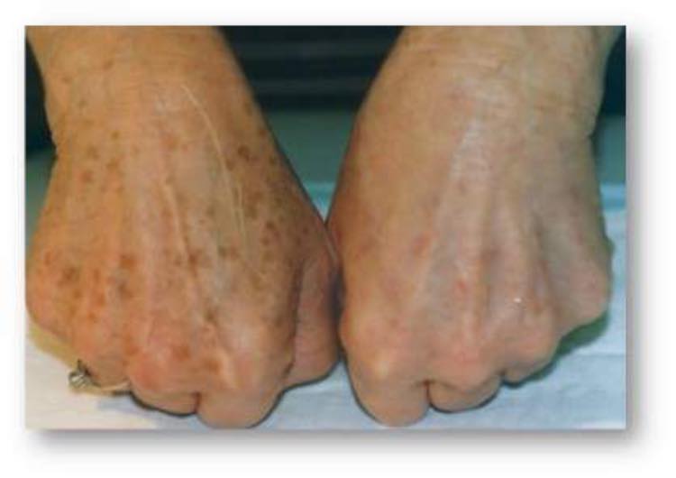 Damas SkinCare SPA & Laser Clinic | 250 Dundas St W Unit 205, Mississauga, ON L5B 1J2, Canada | Phone: (647) 886-0444