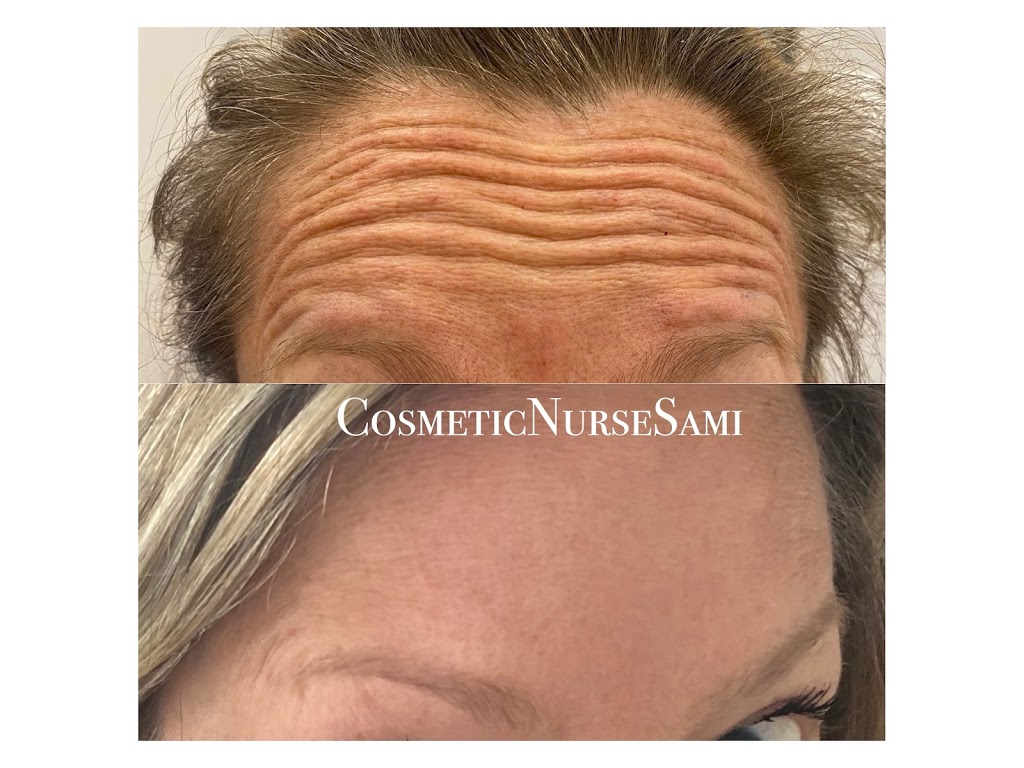 Nurse Samira | 60 Cox St, Cambridge, ON N1S 0A3, Canada | Phone: (416) 561-5106