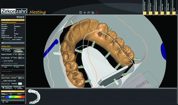 SkyCAD Dental Technology Ltd. (Dental Lab) | 1638 10 Ave SW, Calgary, AB T3C 0J5, Canada | Phone: (403) 970-0600