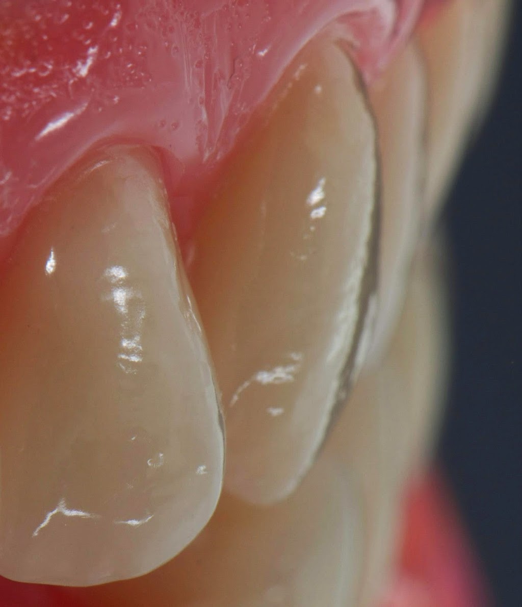 Hicks Dental Laboratory | 3302 Stone St, Port Huron, MI 48060, USA | Phone: (810) 984-4070