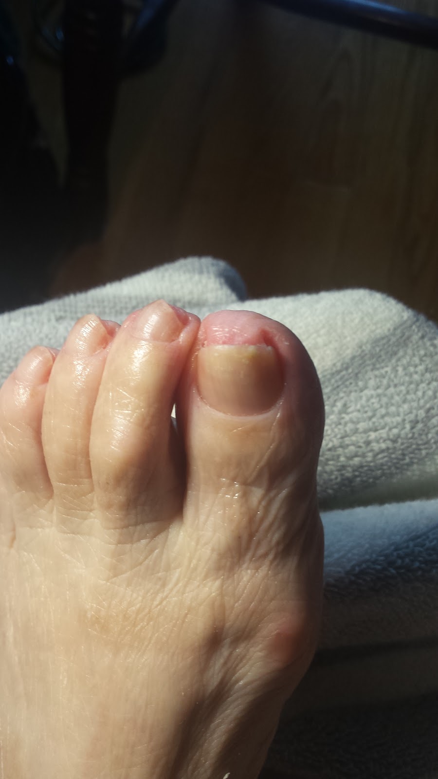 Chantal Gagnier : infirmière en soins de pieds | 12081 Avenue Desaulniers, Montréal-Nord, QC H1G 5J9, Canada | Phone: (514) 755-8082