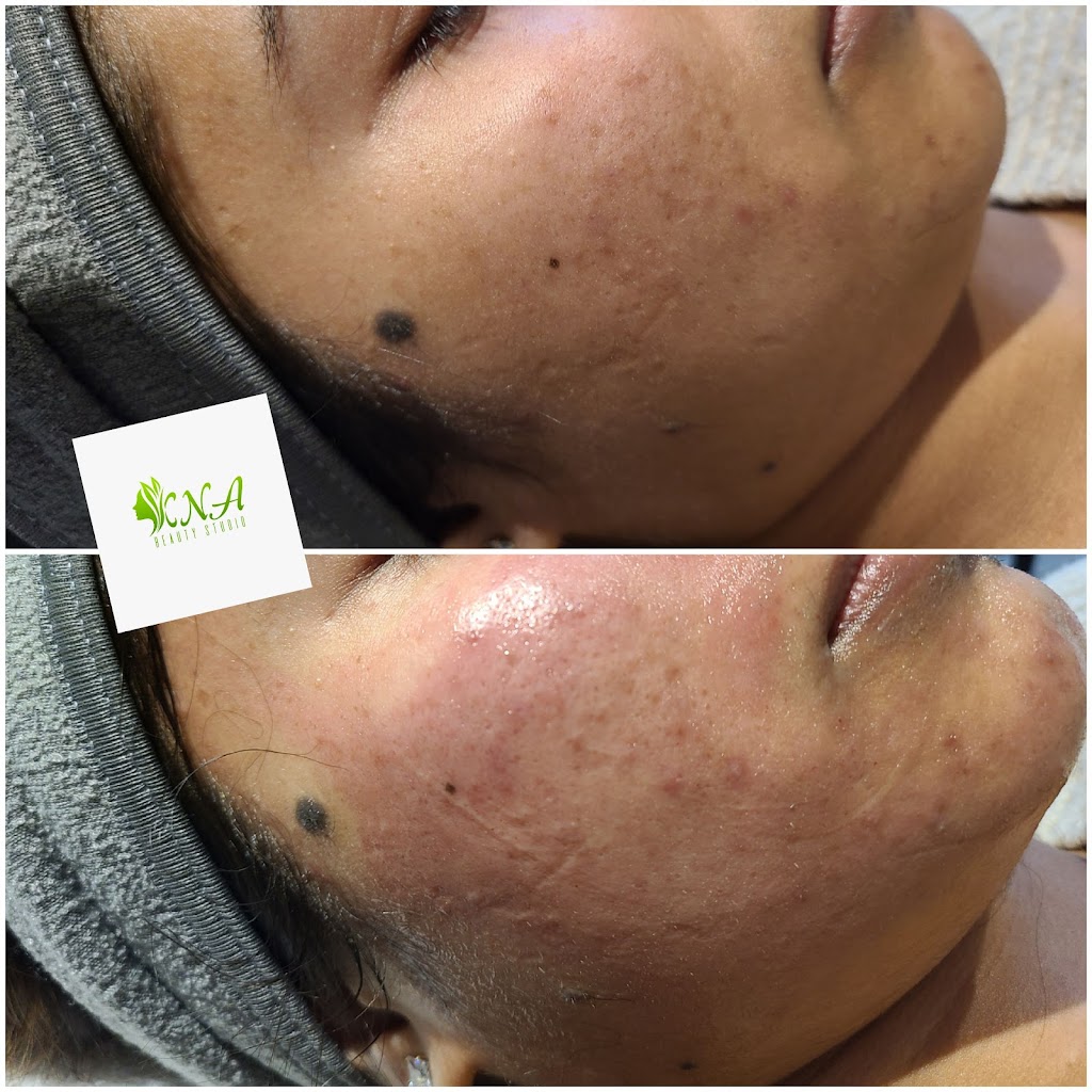 KNA beauty studio | 19 Erlesmere Ave, Brampton, ON L6W 2T4, Canada | Phone: (647) 705-5233