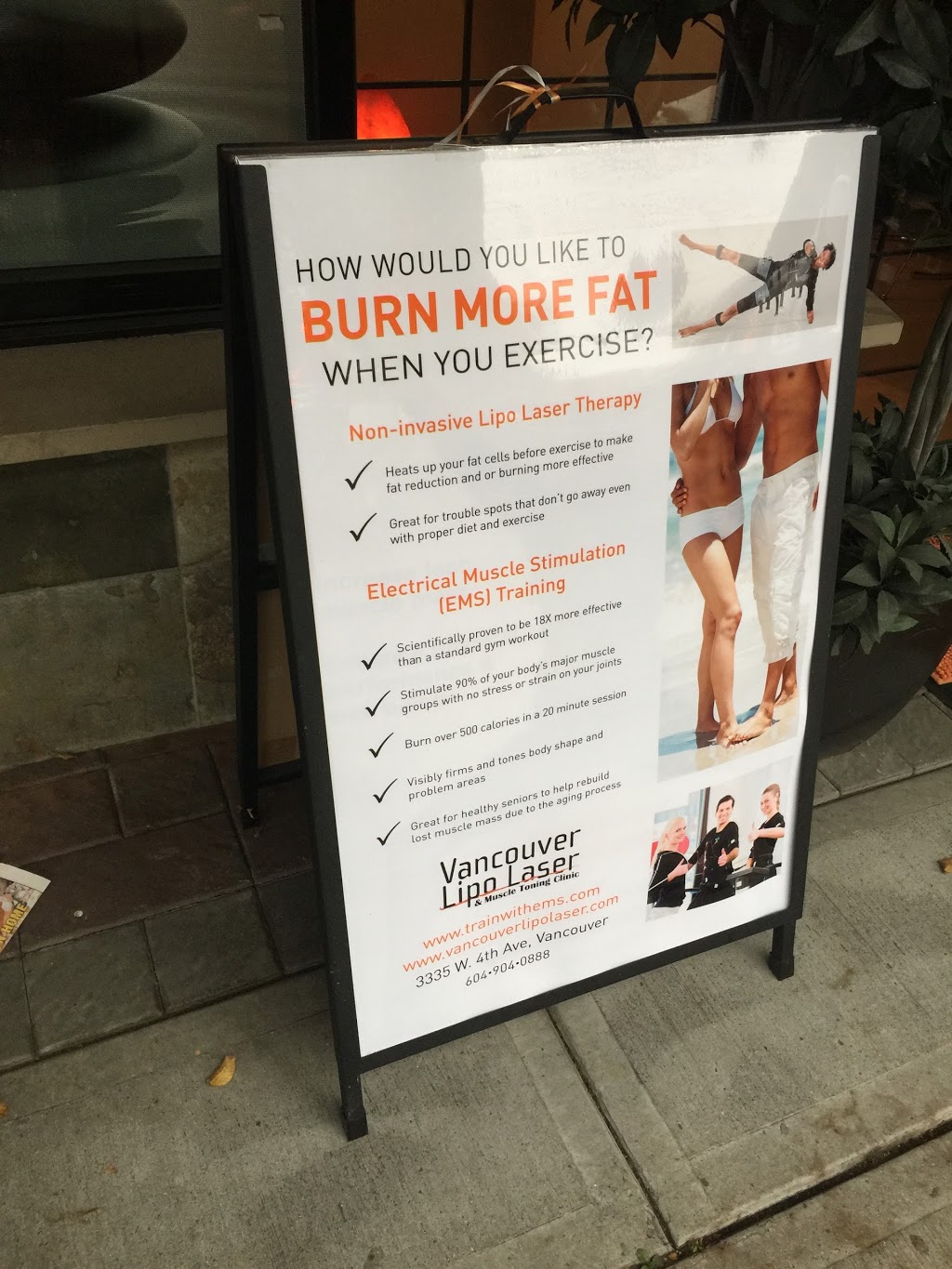 Vancouver Lipolaser | 3345 W 4th Ave, Vancouver, BC V6R 1N6, Canada | Phone: (604) 904-0888