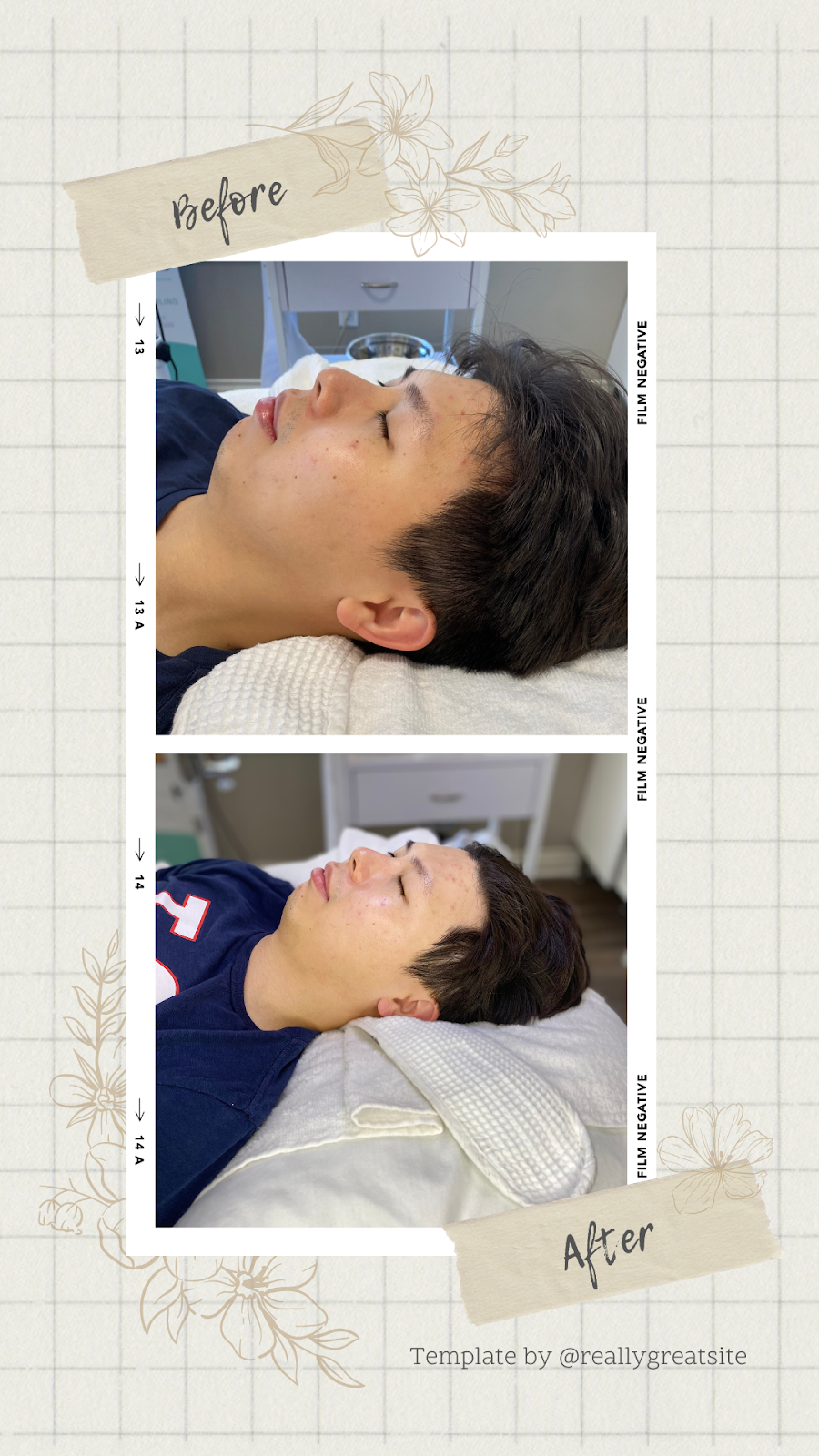 Arga Light Laser& Skin Care | 3059 Timber Ct, Coquitlam, BC V3E 2Y8, Canada | Phone: (604) 838-8445