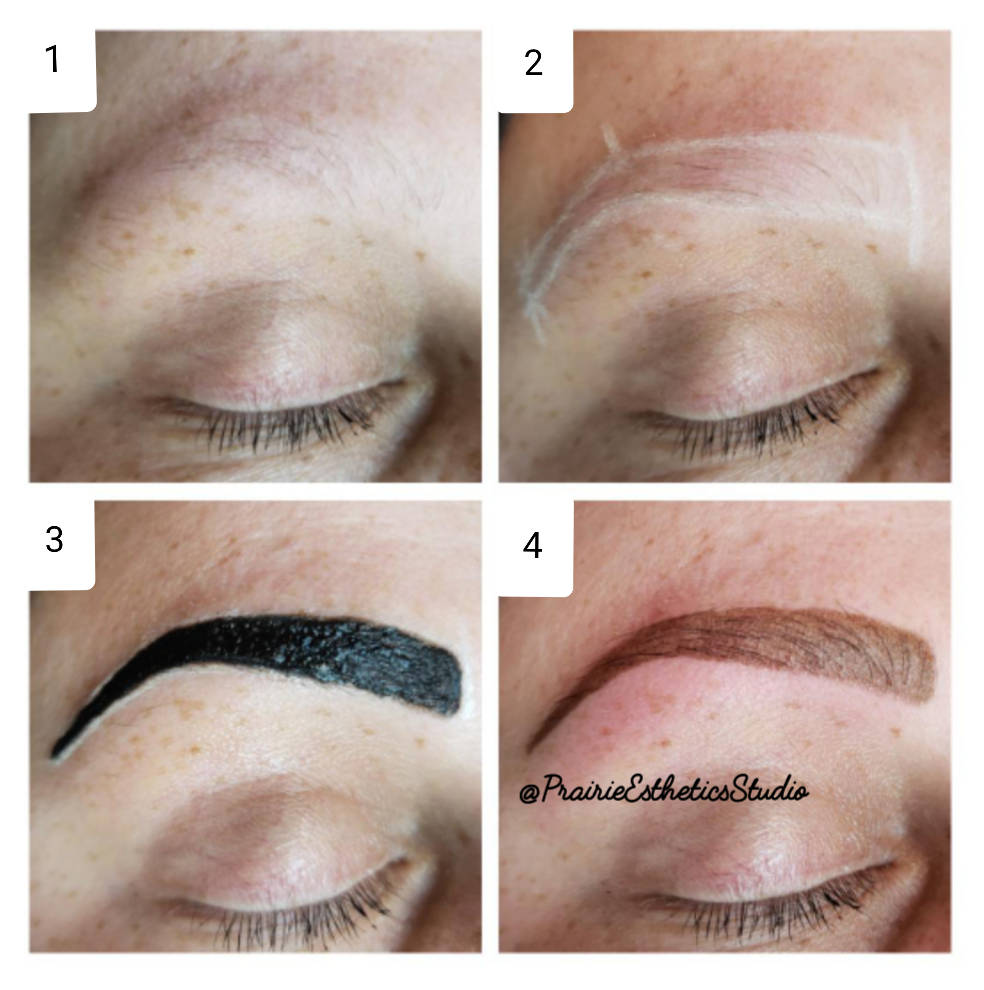 Prairie Esthetics Studio | 3 Torrington Rd, Winnipeg, MB R3Y 1B4, Canada | Phone: (204) 999-0229