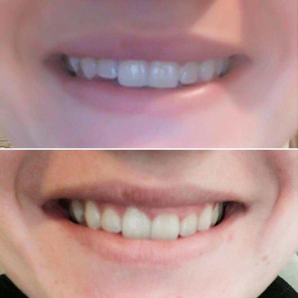 Alexs Beauty Bar | 34 Kidd Street, Bradford, ON L3Z 0V5, Canada | Phone: (416) 274-6805
