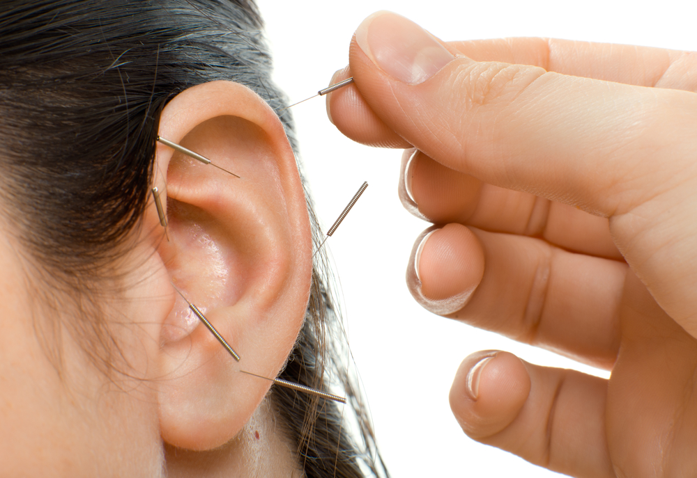 Registered Acupuncture and Massage Therapy | 1136 Aldersbrook Rd, London, ON N6G 2X8, Canada | Phone: (519) 601-5436