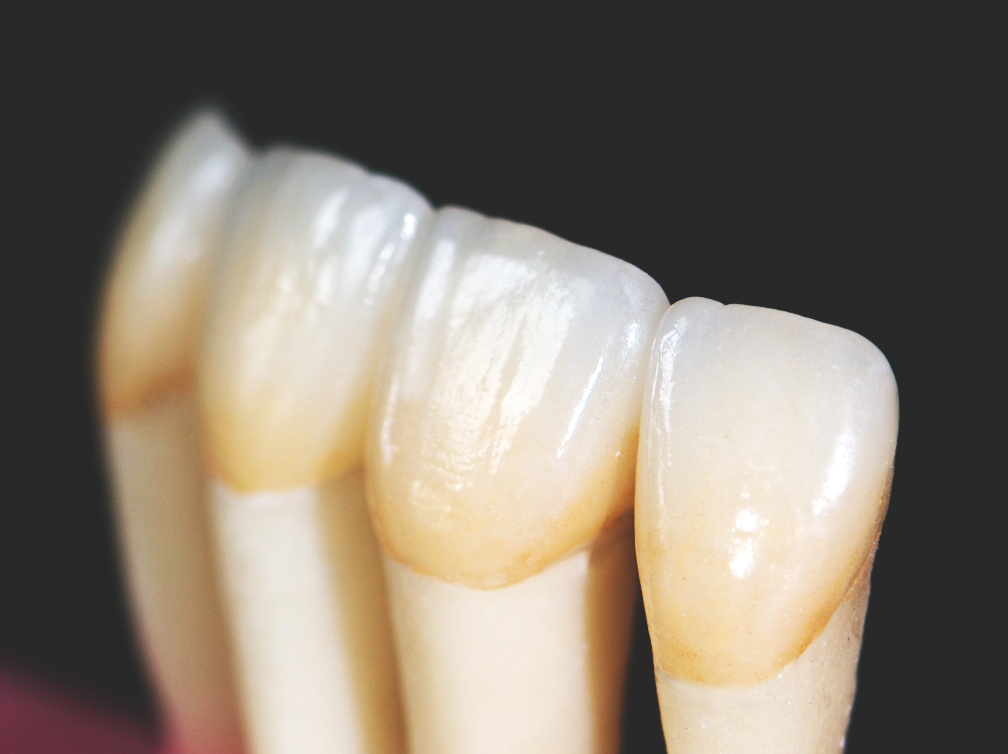 DEN-TECH London Laboratory | 1373 Westdel Bourne, London, ON N6K 4R1, Canada | Phone: (519) 657-7109