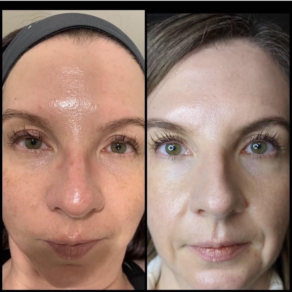 Alis Skin + Laser | 491 Wt Hill Blvd S #60, Lethbridge, AB T1J 1Y6, Canada | Phone: (403) 381-8295
