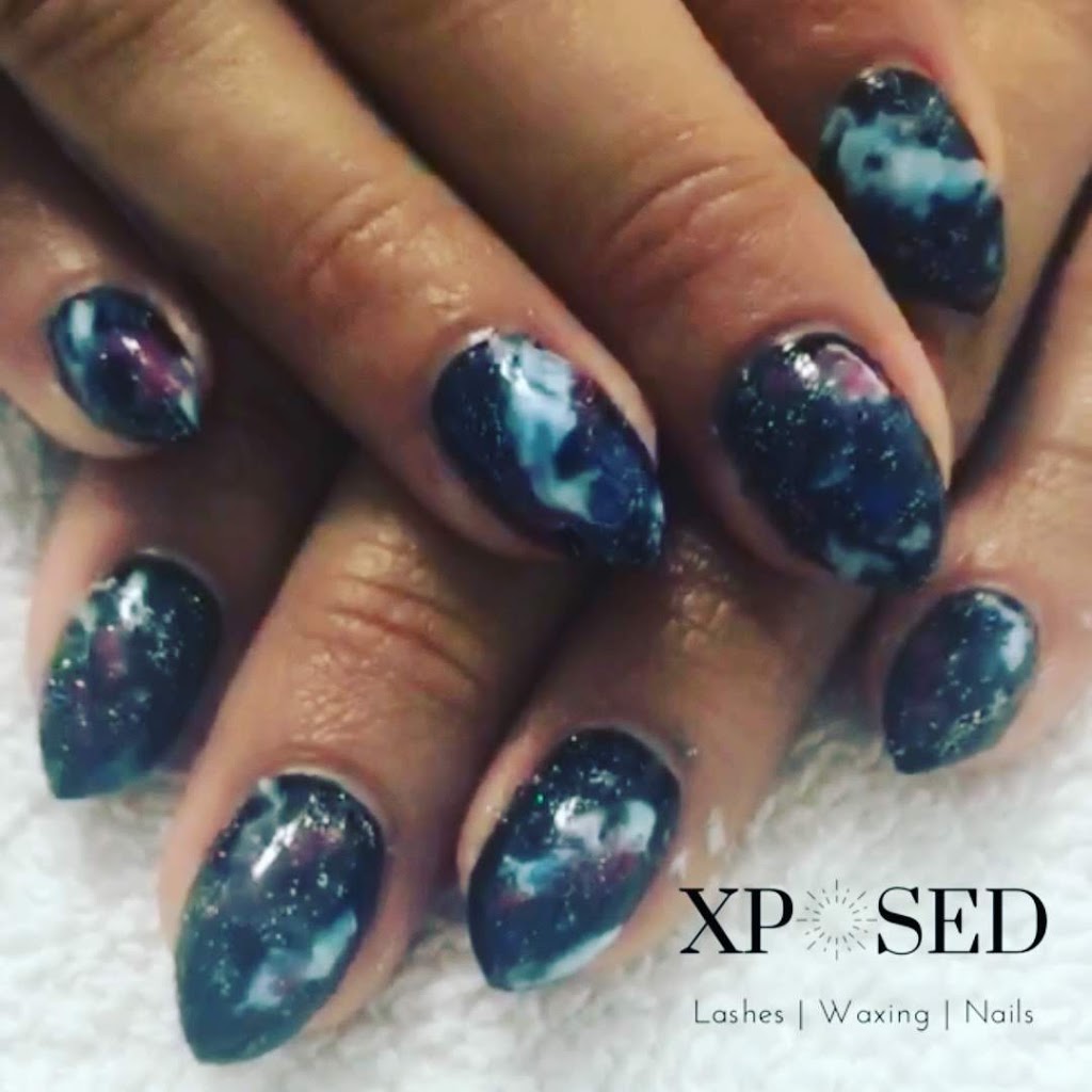 Xposed Esthetics | 529 Baycroft Dr, Martensville, SK S0K 2T2, Canada | Phone: (306) 203-4643