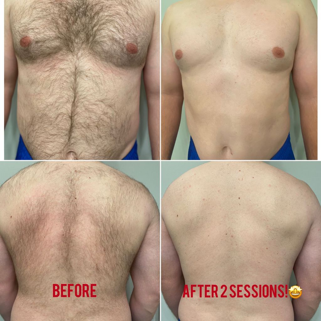 Royal Skincare Clinic | 19991 96 Ave, Langley, BC V1M 3C6, Canada | Phone: (778) 298-7546