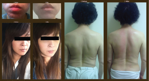Sarah Jung Spa | 1150 Austin Ave #101, Coquitlam, BC V3K 3P5, Canada | Phone: (604) 636-8377