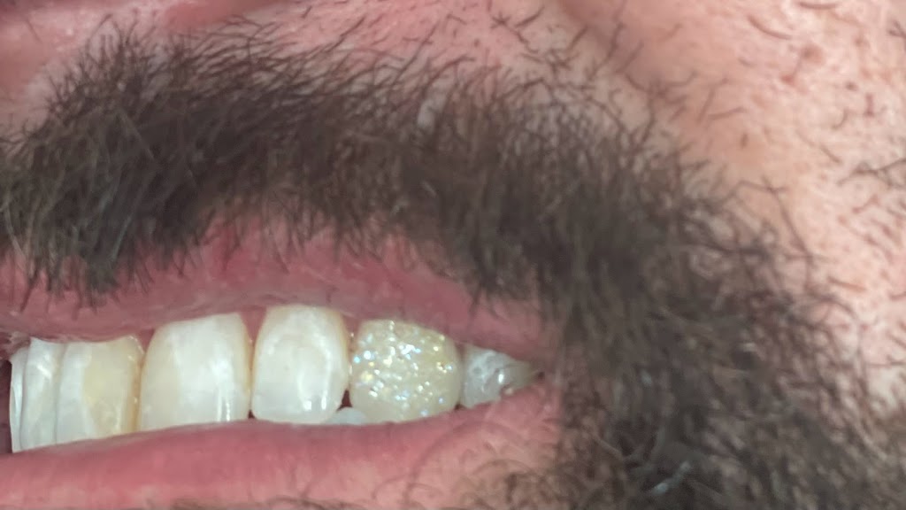 Smirk to Smile Teeth Whitening | 10 Jensen Crescent NE, Airdrie, AB T4B 1P4, Canada | Phone: (403) 404-1421