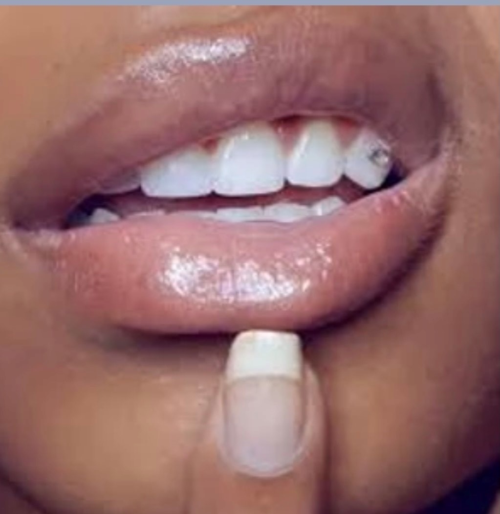 Blanche Smiles | 274 Markham Rd, Scarborough, ON M1J 3C5, Canada | Phone: (416) 885-1311