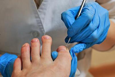 Accelerated Cast Clinic & Limb Preservation Centre | 201-6040 Andrews Way SW, Edmonton, AB T6W 3S9, Canada | Phone: (780) 907-2082
