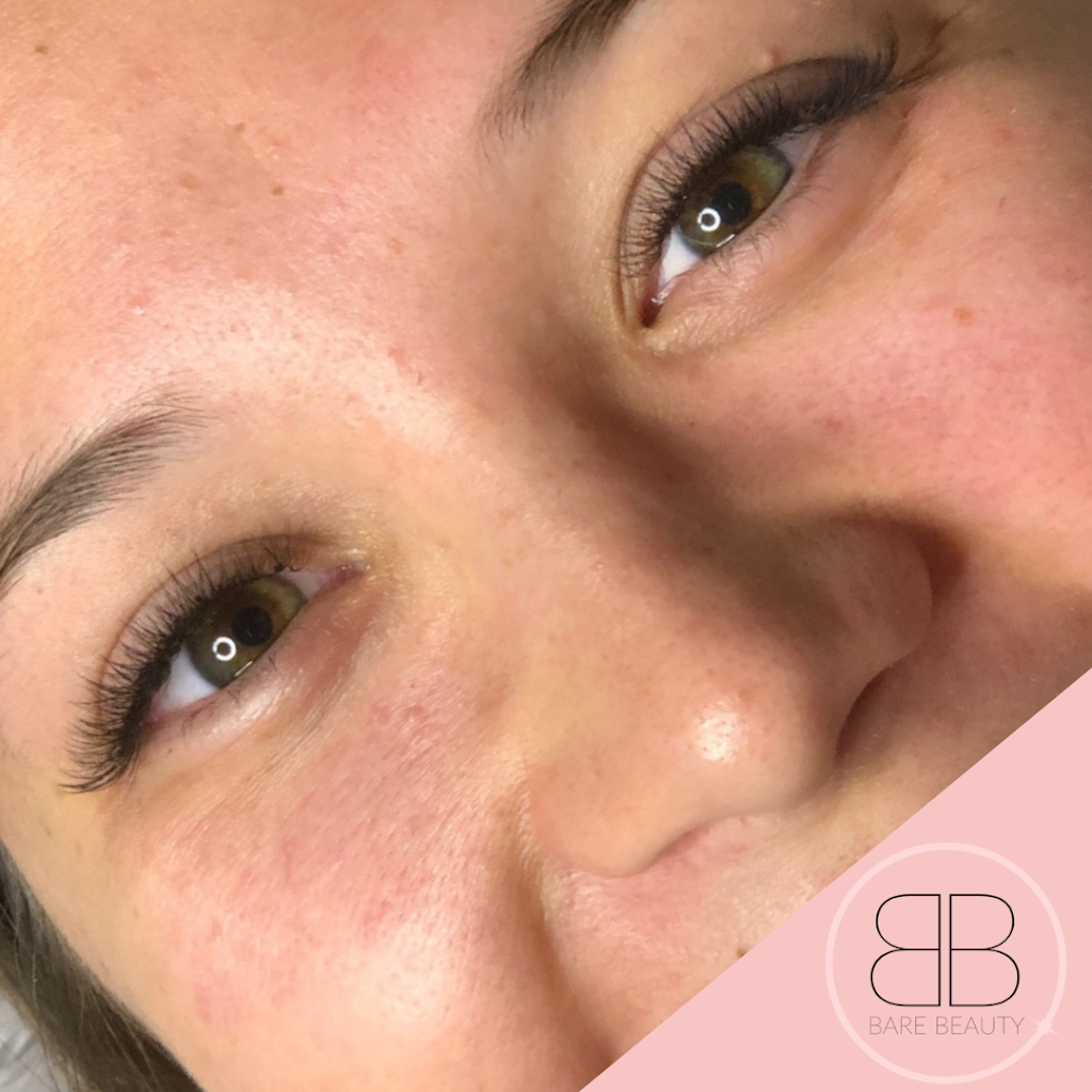 Bare Beauty Aesthetics | 976 Shadeland Ave #3, Burlington, ON L7T 2M5, Canada | Phone: (289) 208-3634