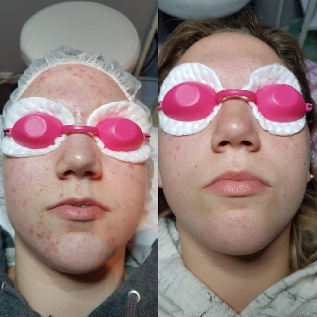 Sweet Expressions MediSpa | 35 Galbraith Ct, Bowmanville, ON L1C 4P5, Canada | Phone: (905) 914-7995
