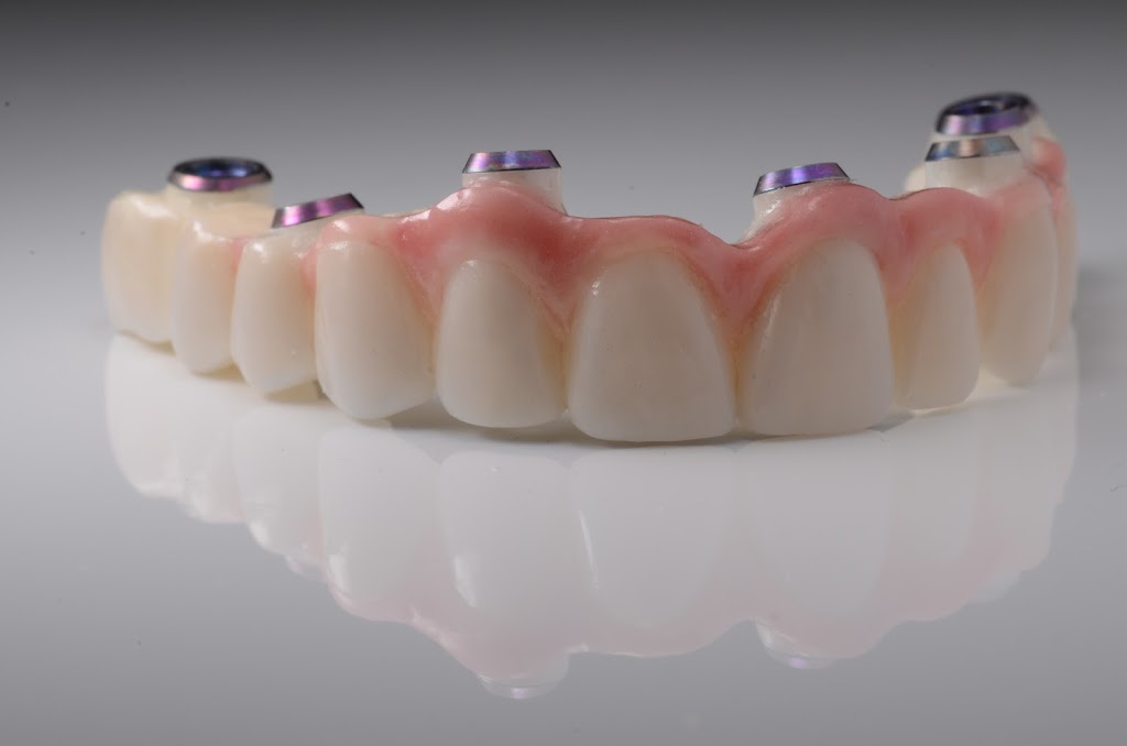 Dr Philippe Girard Prosthodontiste | 1145 Boulevard Lebourgneuf #100, Québec, QC G2K 2K8, Canada | Phone: (418) 624-7333