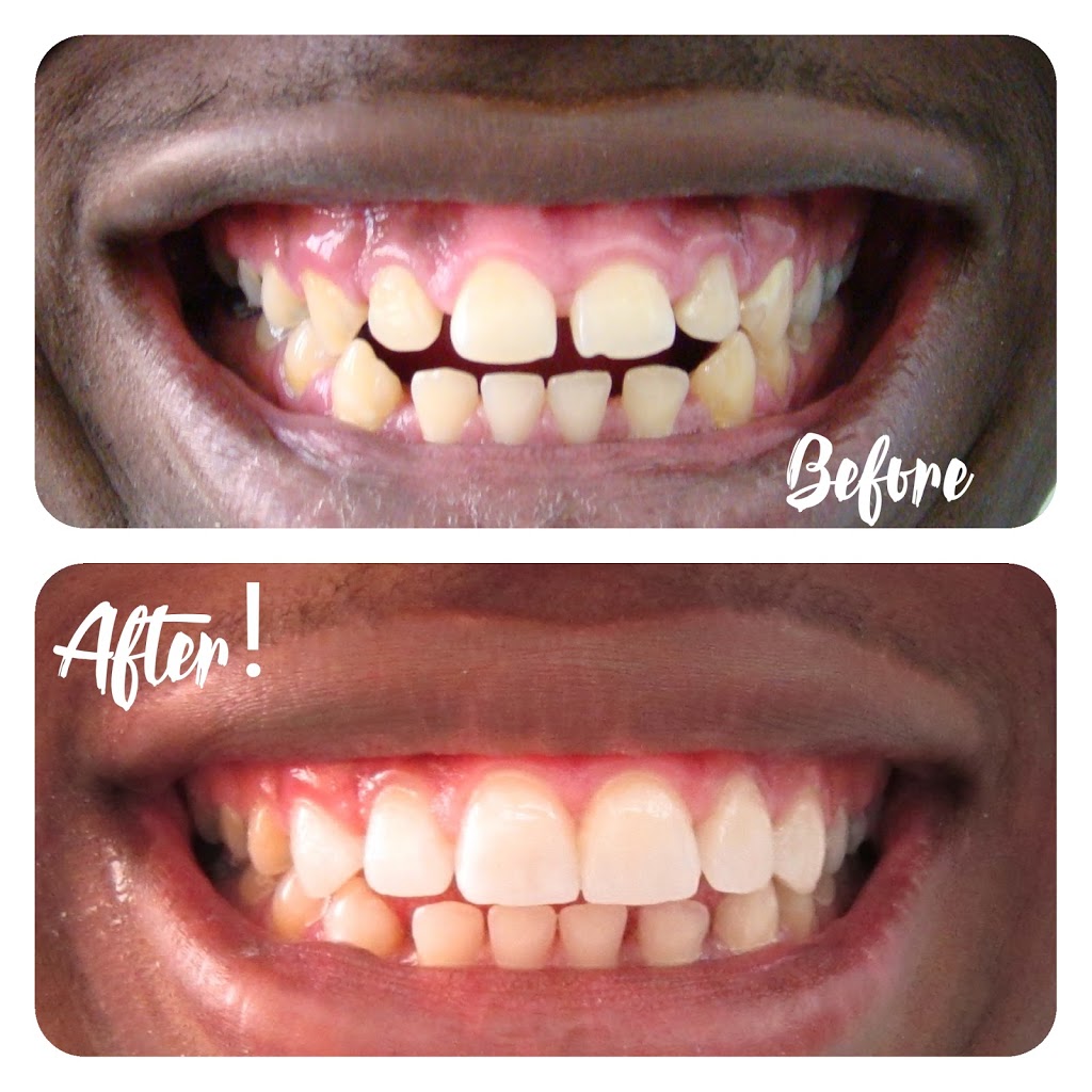 Trio Dentistry | 3163 Winston Churchill Blvd, Mississauga, ON L5L 2W1, Canada | Phone: (905) 812-1818