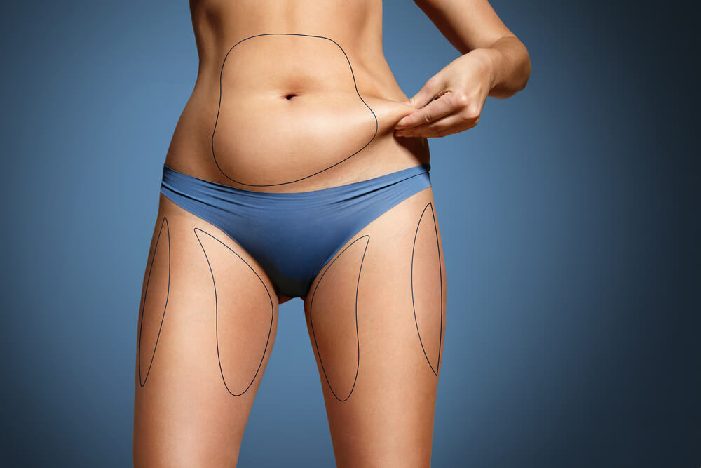 JDerma Clinics ( Botox - Fillers - Laser ) | 3245 Preserve Dr, Oakville, ON L6M 4J9, Canada | Phone: (647) 700-5570