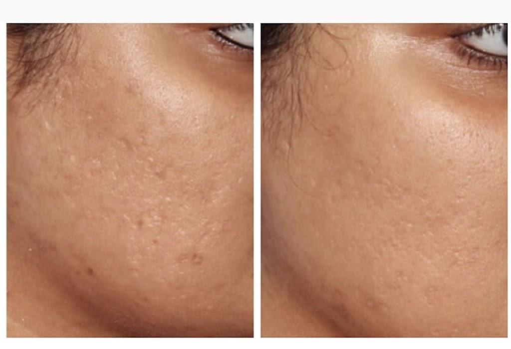 the YOU effect | 64 Hatt St, Dundas, ON L9H 7T6, Canada | Phone: (289) 270-4569